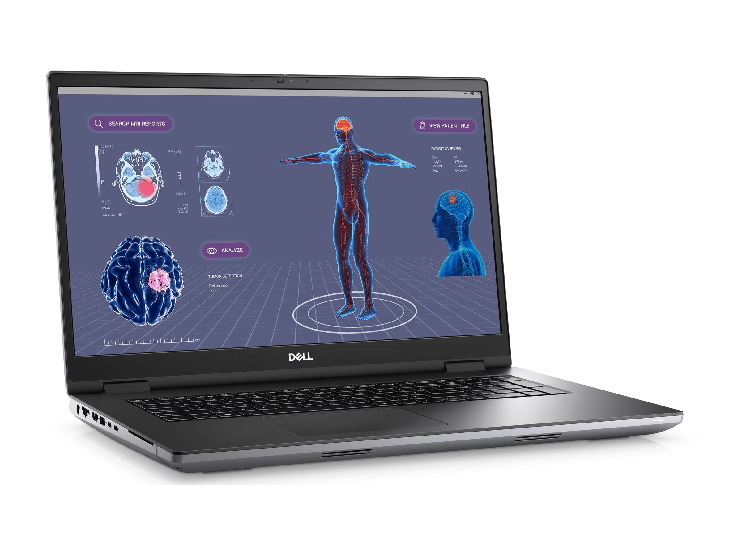 DELL Refurb Precision 17-7780 i7-13850HX - Pilt 3