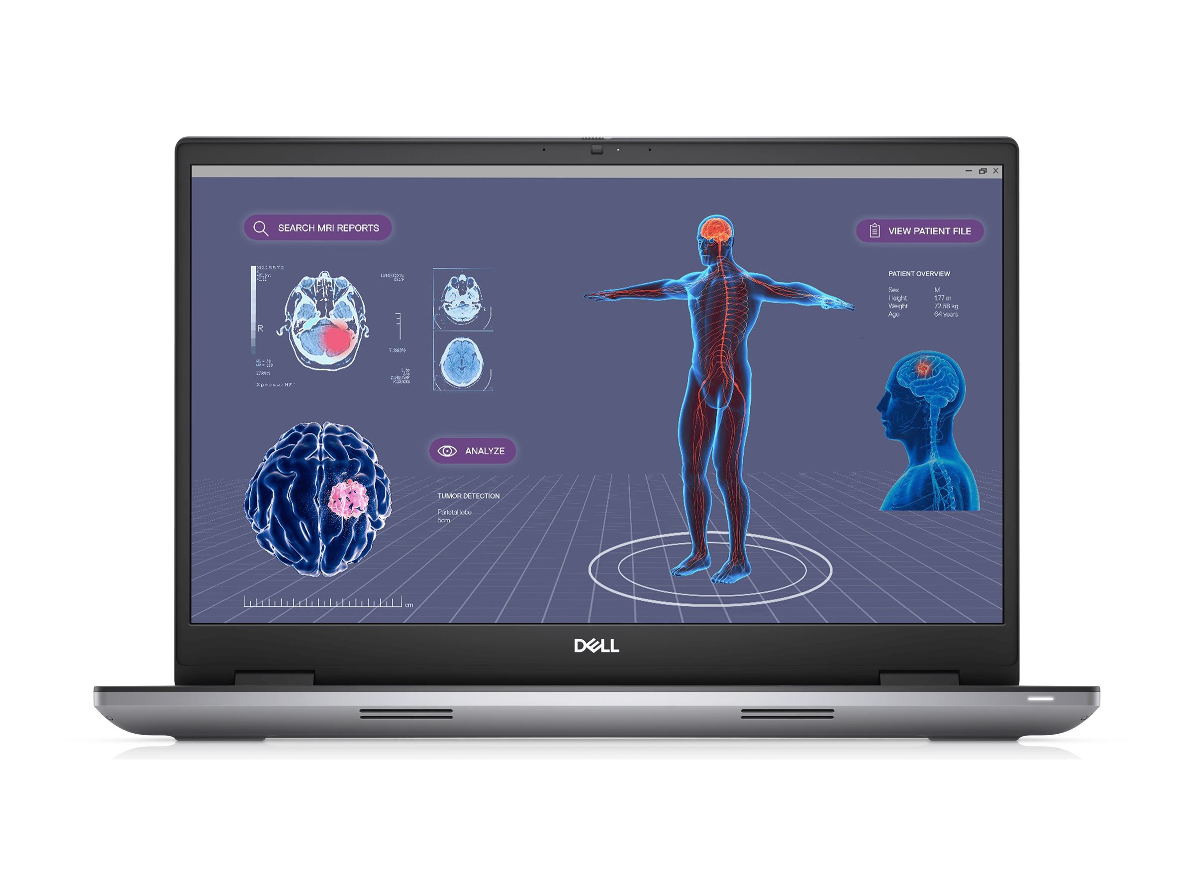 DELL Refurb Precision 17-7780 i9-13950HX — изображение 5
